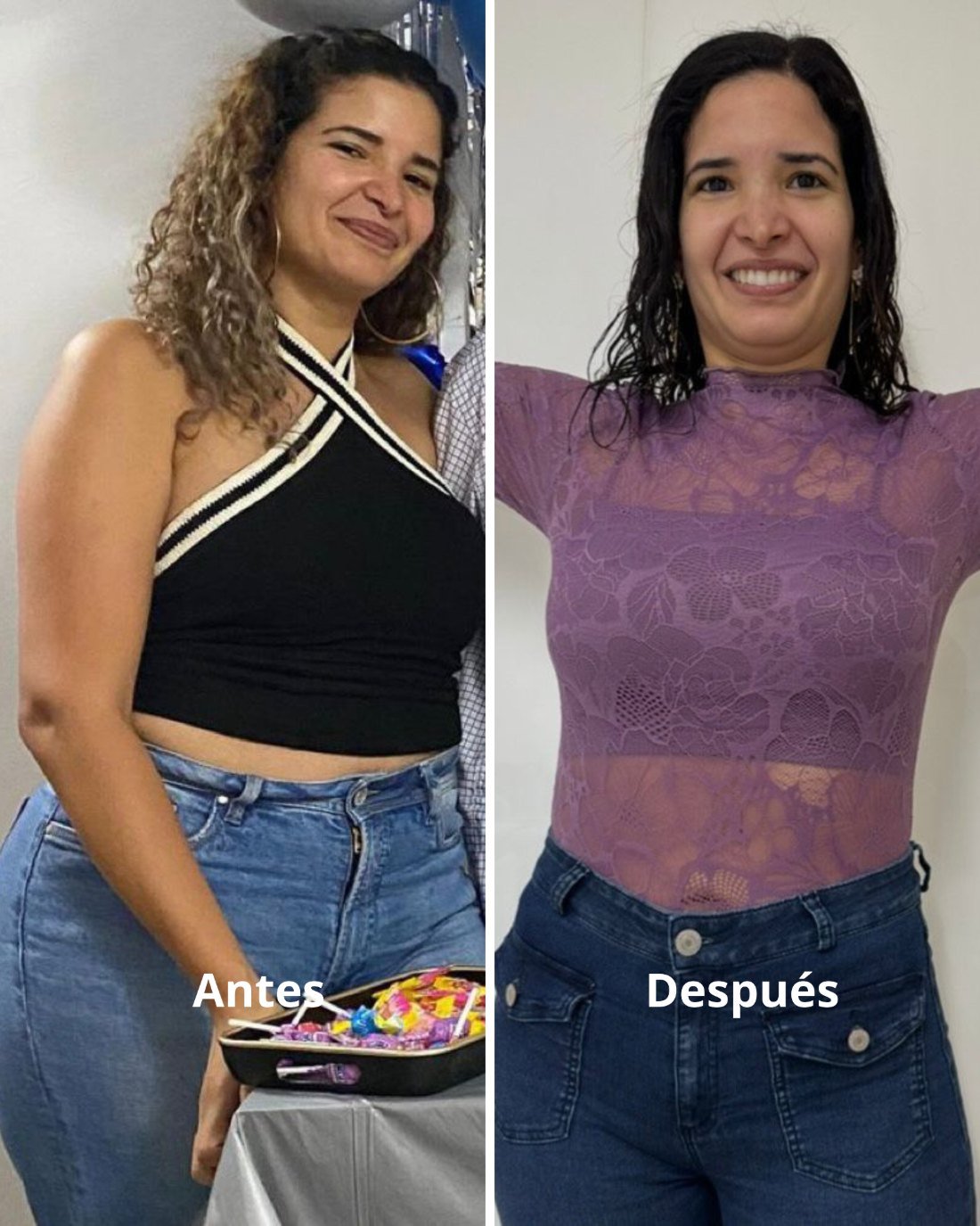 Antes y después · Daniela Restrepo