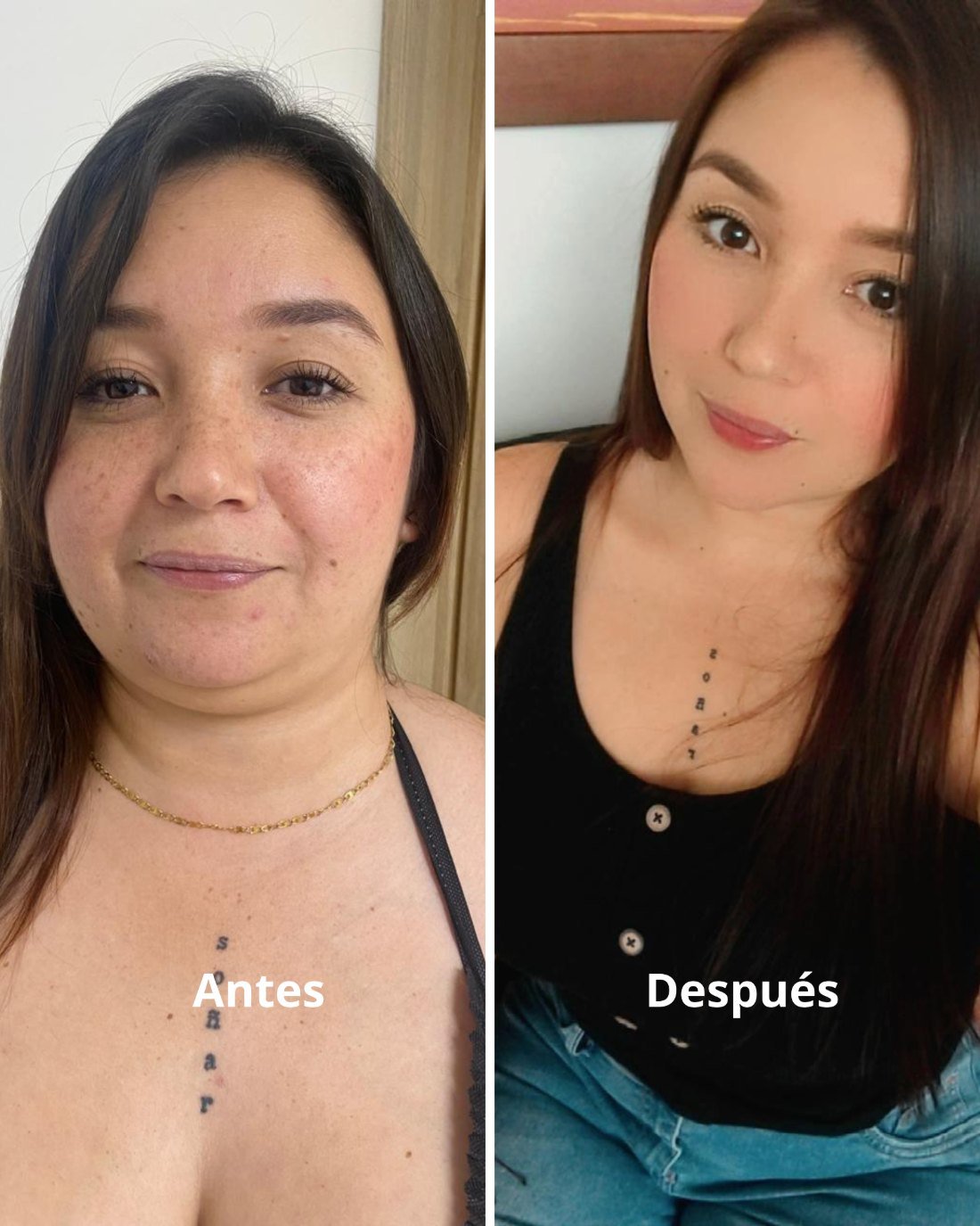 Antes y después · Diana Celis